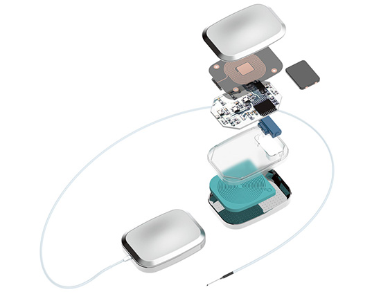 Smart active miniature implants