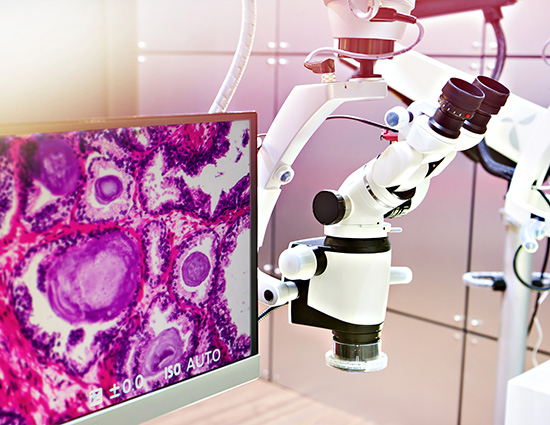 AI-powered digital pathology