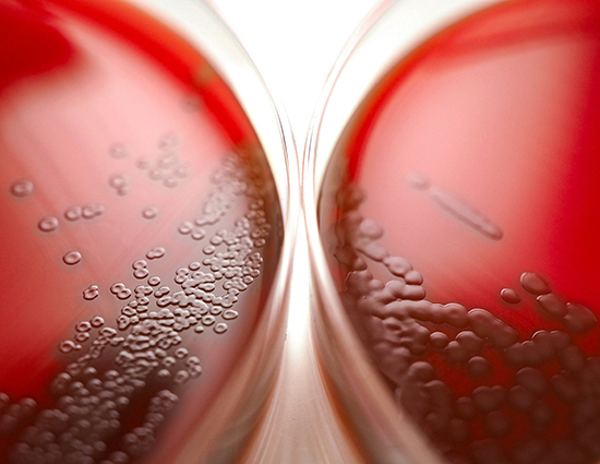 Primary care diagnostics are key to addressing antimicrobial resistance