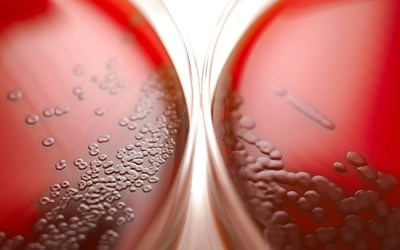 Primary care diagnostics are key to addressing antimicrobial resistance